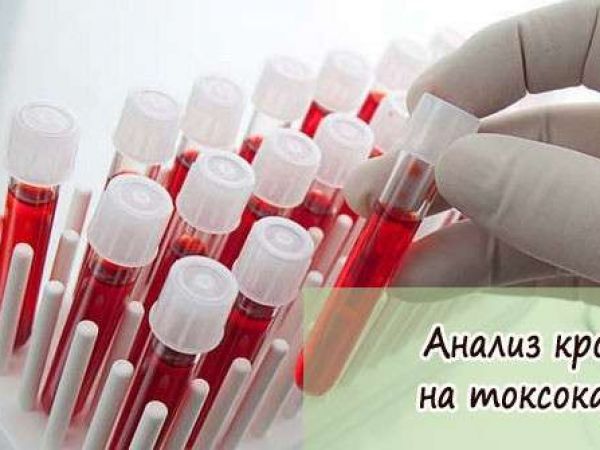 Что значит антитела igg к токсокарам в анализе крови