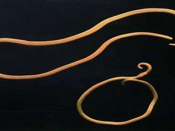 Этапы жизненного цикла развития различных видов ленточных червей