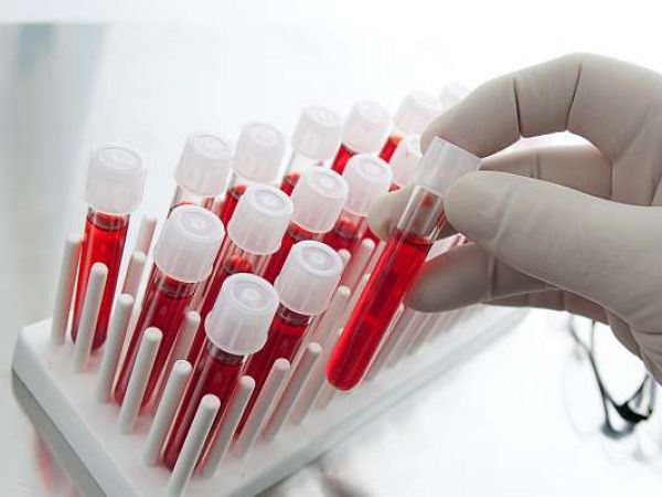 Как сдавать анализы крови на лямблии и его расшифровка