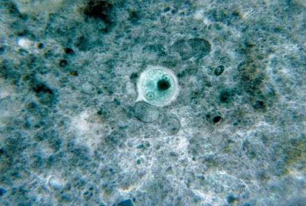 амеба под микроскопом