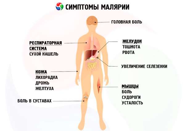 симптомы малярии