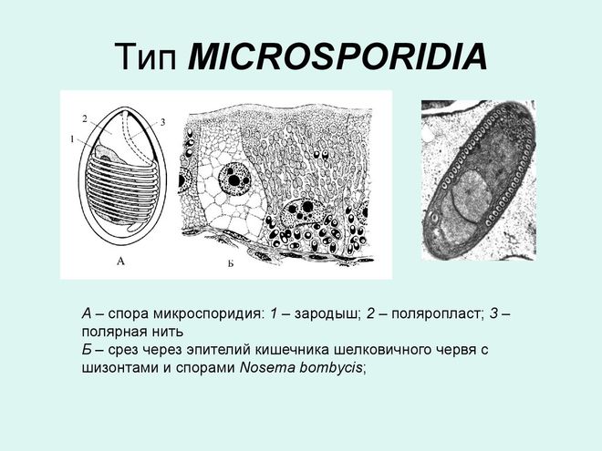 Цикл развития микроспоридии